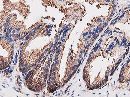 OGFOD1 Antibody in Immunohistochemistry (Paraffin) (IHC (P))