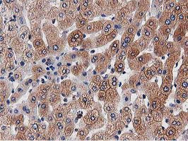 OGFOD1 Antibody in Immunohistochemistry (Paraffin) (IHC (P))