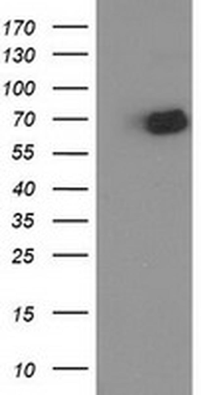 OGFOD1 Antibody in Western Blot (WB)