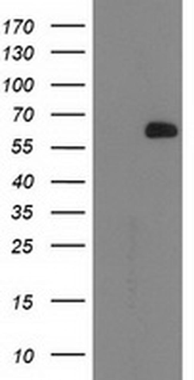 OGFOD1 Antibody in Western Blot (WB)