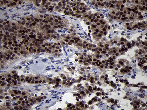 OIP5 Antibody in Immunohistochemistry (Paraffin) (IHC (P))