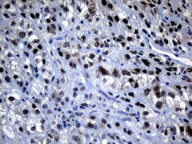 OIP5 Antibody in Immunohistochemistry (Paraffin) (IHC (P))