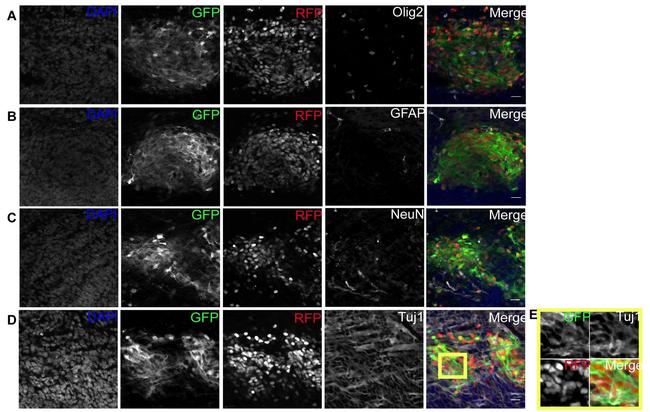 OLIG2 Antibody in Immunohistochemistry (IHC)