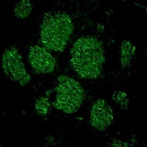 NEFM Antibody in Immunohistochemistry (Frozen) (IHC (F))