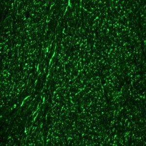 NEFM Antibody in Immunohistochemistry (Frozen) (IHC (F))