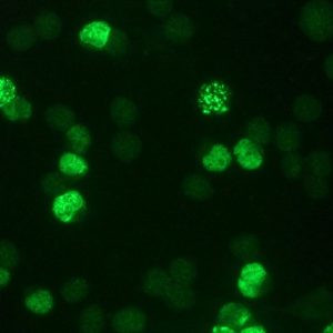 BrdU Antibody in Immunocytochemistry (ICC/IF)