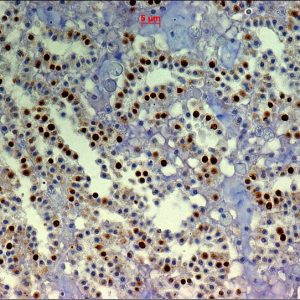 BrdU Antibody in Immunohistochemistry (Paraffin) (IHC (P))