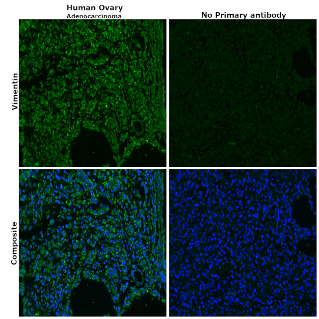 Vimentin Antibody in Immunohistochemistry (Paraffin) (IHC (P))