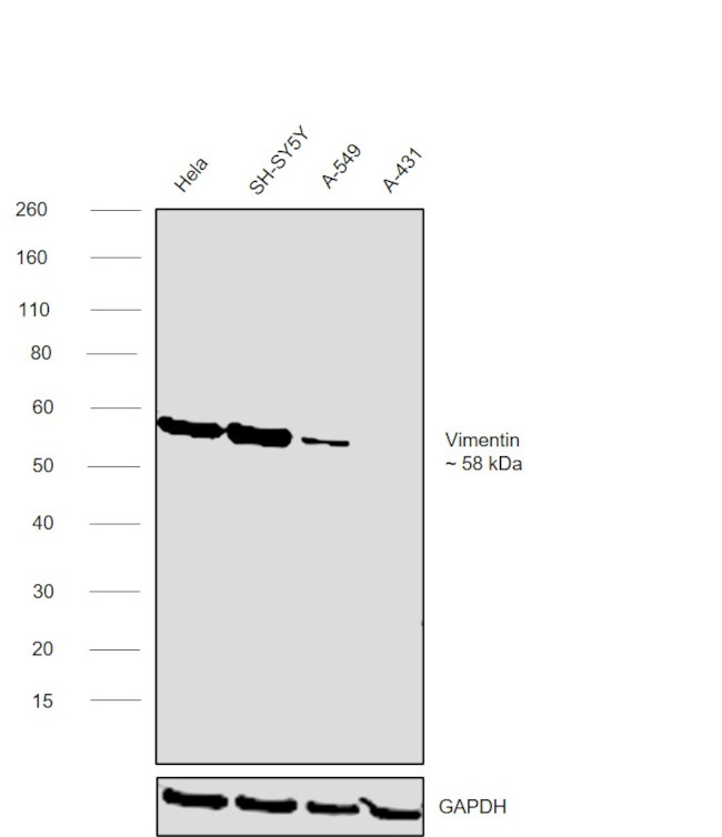 Vimentin Antibody