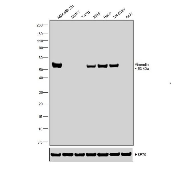 Vimentin Antibody