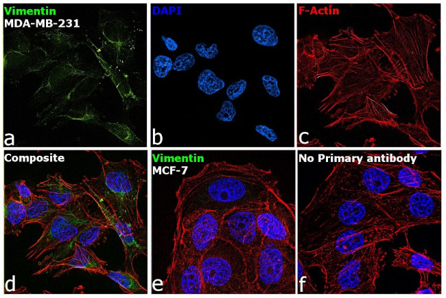 Vimentin Antibody in Immunocytochemistry (ICC/IF)