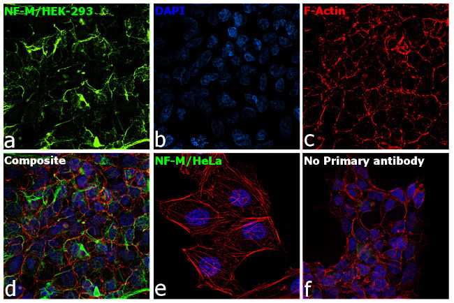 NEFM Antibody in Immunocytochemistry (ICC/IF)