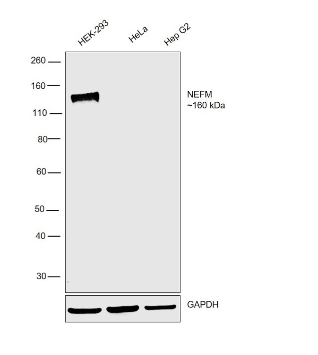 NEFM Antibody