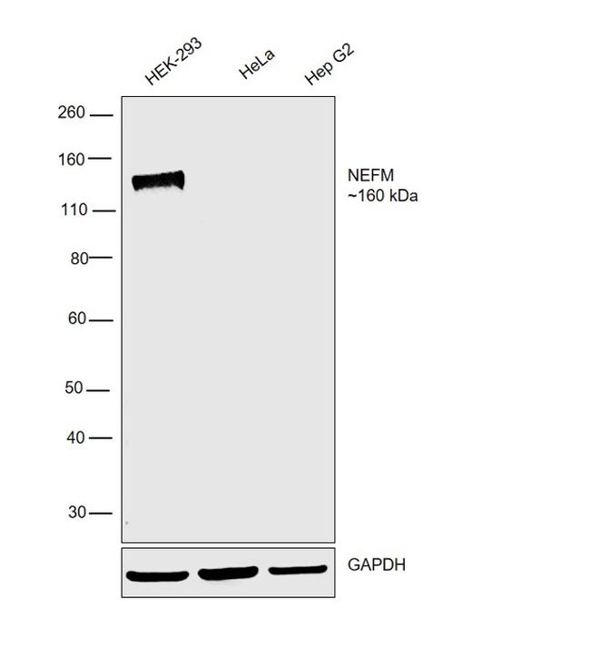 NEFM Antibody in Western Blot (WB)