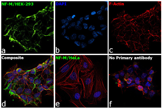 NEFM Antibody