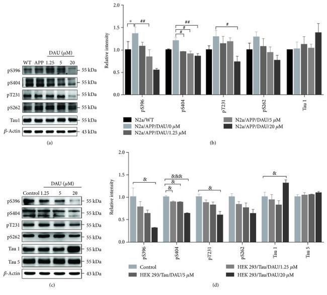 Phospho-Tau (Ser262) Antibody in Western Blot (WB)