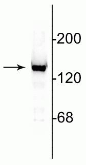 NMDAR2C Antibody in Western Blot (WB)