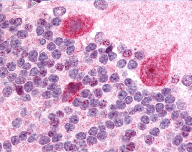 GABRG2 Antibody in Immunohistochemistry (IHC)