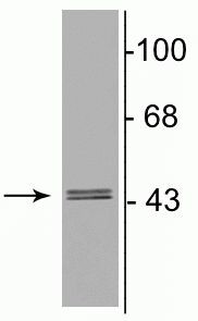 GABRG2 Antibody in Western Blot (WB)