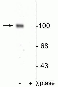 Phospho-GluR1 (Ser845) Antibody in Western Blot (WB)