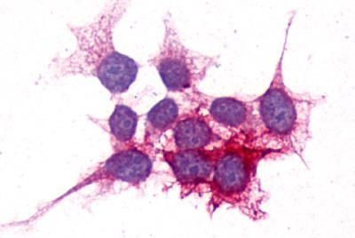 P2Y14 Antibody in Immunocytochemistry (ICC/IF)