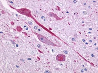 P2Y14 Antibody in Immunohistochemistry (Paraffin) (IHC (P))