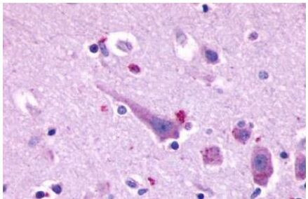 Prokineticin Receptor 2 Antibody in Immunohistochemistry (Paraffin) (IHC (P))