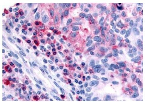 HRH4 Antibody in Immunohistochemistry (Paraffin) (IHC (P))