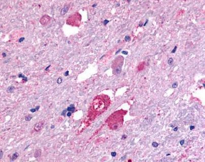 GALR2 Antibody in Immunohistochemistry (Paraffin) (IHC (P))