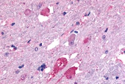 GALR2 Antibody in Immunohistochemistry (Paraffin) (IHC (P))