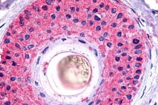 GALR2 Antibody in Immunohistochemistry (Paraffin) (IHC (P))