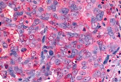 GALR2 Antibody in Immunohistochemistry (Paraffin) (IHC (P))