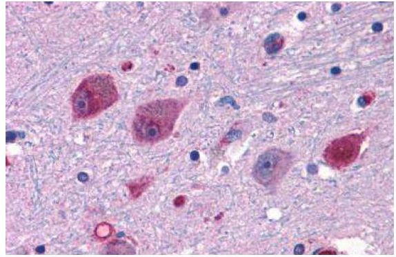 P2Y14 Antibody in Immunohistochemistry (Paraffin) (IHC (P))