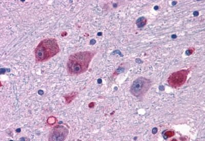 P2Y14 Antibody in Immunohistochemistry (Paraffin) (IHC (P))