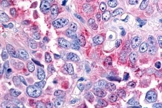 RON Antibody in Immunohistochemistry (Paraffin) (IHC (P))