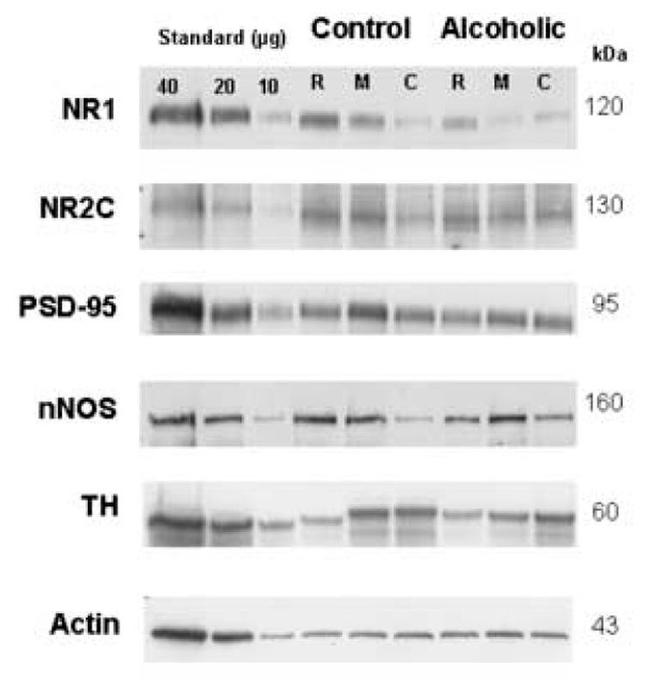 NMDAR2C Antibody in Western Blot (WB)