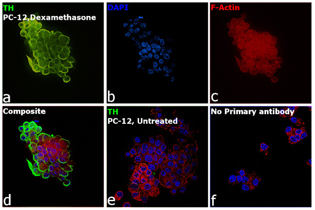 Tyrosine Hydroxylase Antibody in Immunocytochemistry (ICC/IF)