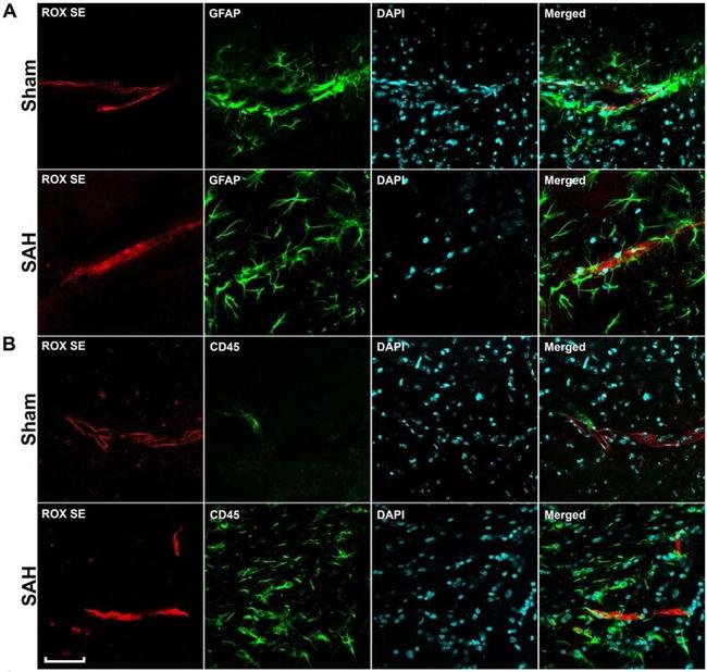 GFAP Antibody in Immunohistochemistry (IHC)