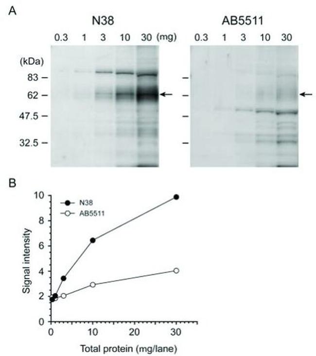 OPRM1 Antibody in Western Blot (WB)