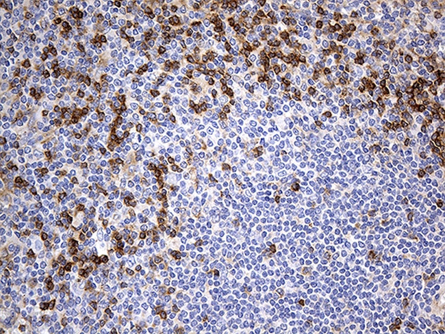 OPTN Antibody in Immunohistochemistry (Paraffin) (IHC (P))