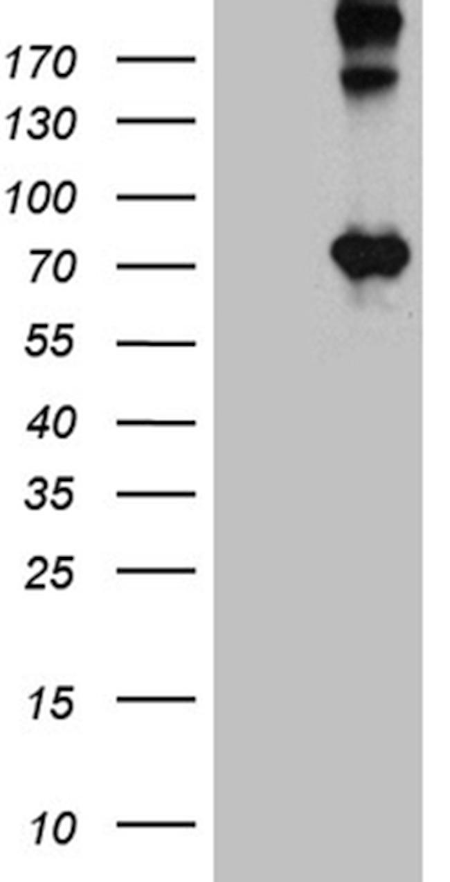 OPTN Antibody in Western Blot (WB)