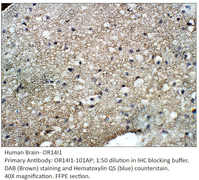 OR14I1 Antibody in Immunohistochemistry (IHC)