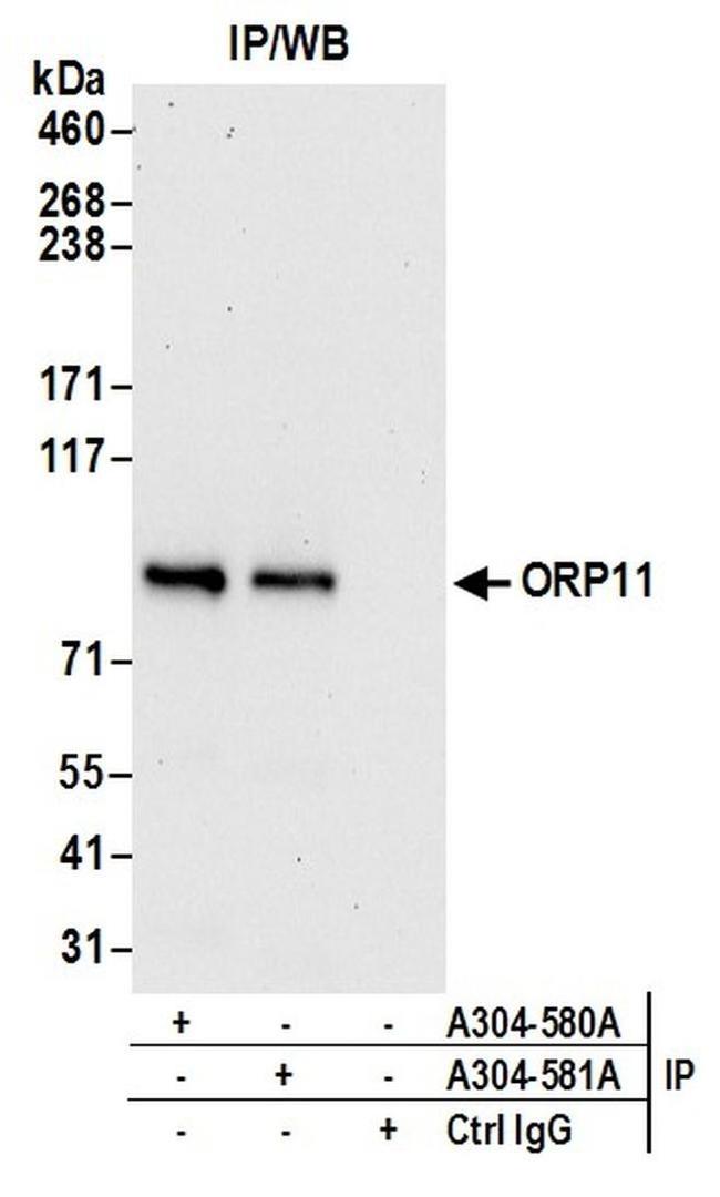 ORP11 Antibody in Western Blot (WB)