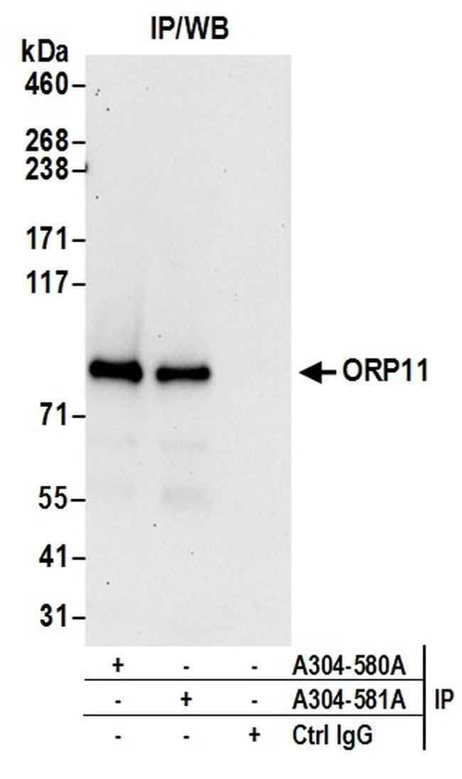 ORP11 Antibody in Western Blot (WB)