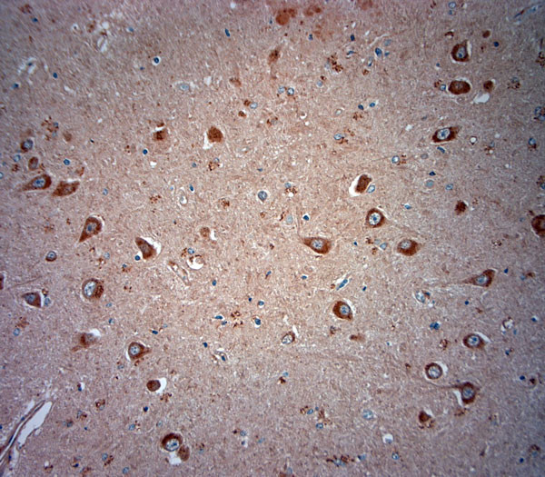 ATG10 Antibody in Immunohistochemistry (Paraffin) (IHC (P))