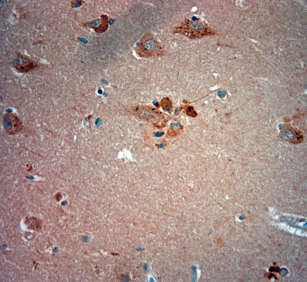 ATG10 Antibody in Immunohistochemistry (Paraffin) (IHC (P))