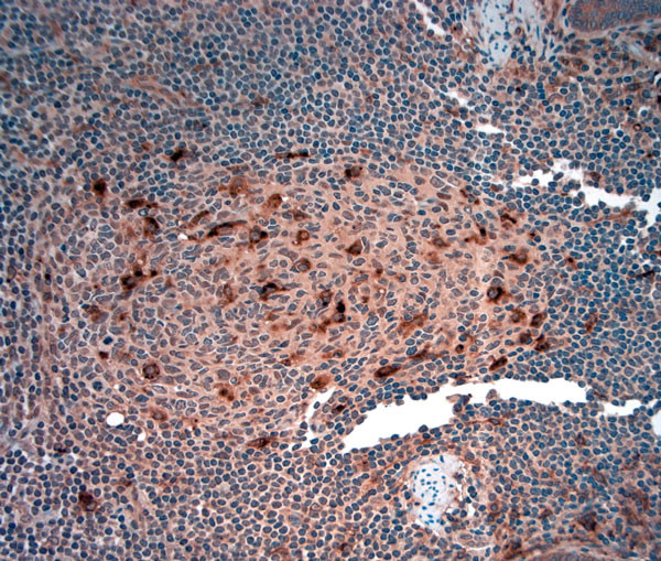 ATG4D Antibody in Immunohistochemistry (Paraffin) (IHC (P))