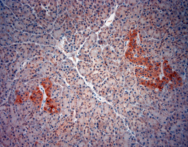 ATG4D Antibody in Immunohistochemistry (Paraffin) (IHC (P))