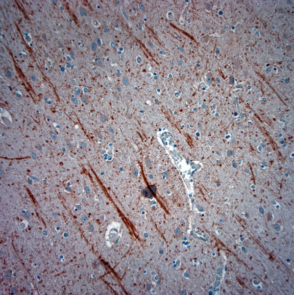 ATG4D Antibody in Immunohistochemistry (Paraffin) (IHC (P))