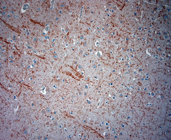 ATG4D Antibody in Immunohistochemistry (Paraffin) (IHC (P))